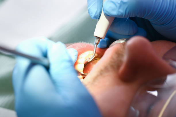 Best Tooth Infection Emergency Dentist  in Gold Bar, WA