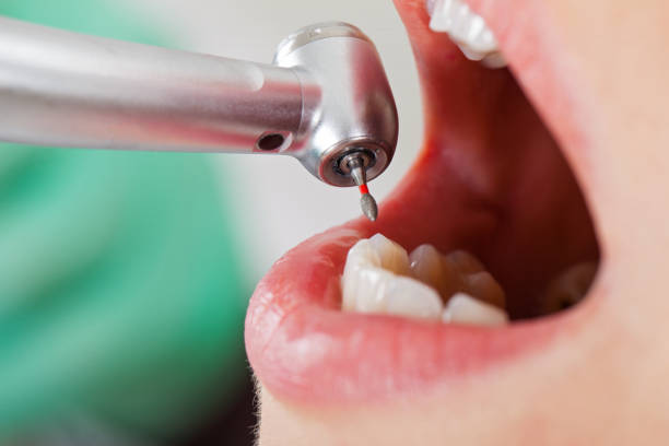 Best Cracked Tooth Emergency Dentist  in Gold Bar, WA